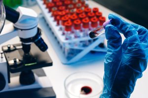 Blood Testing In a Lab